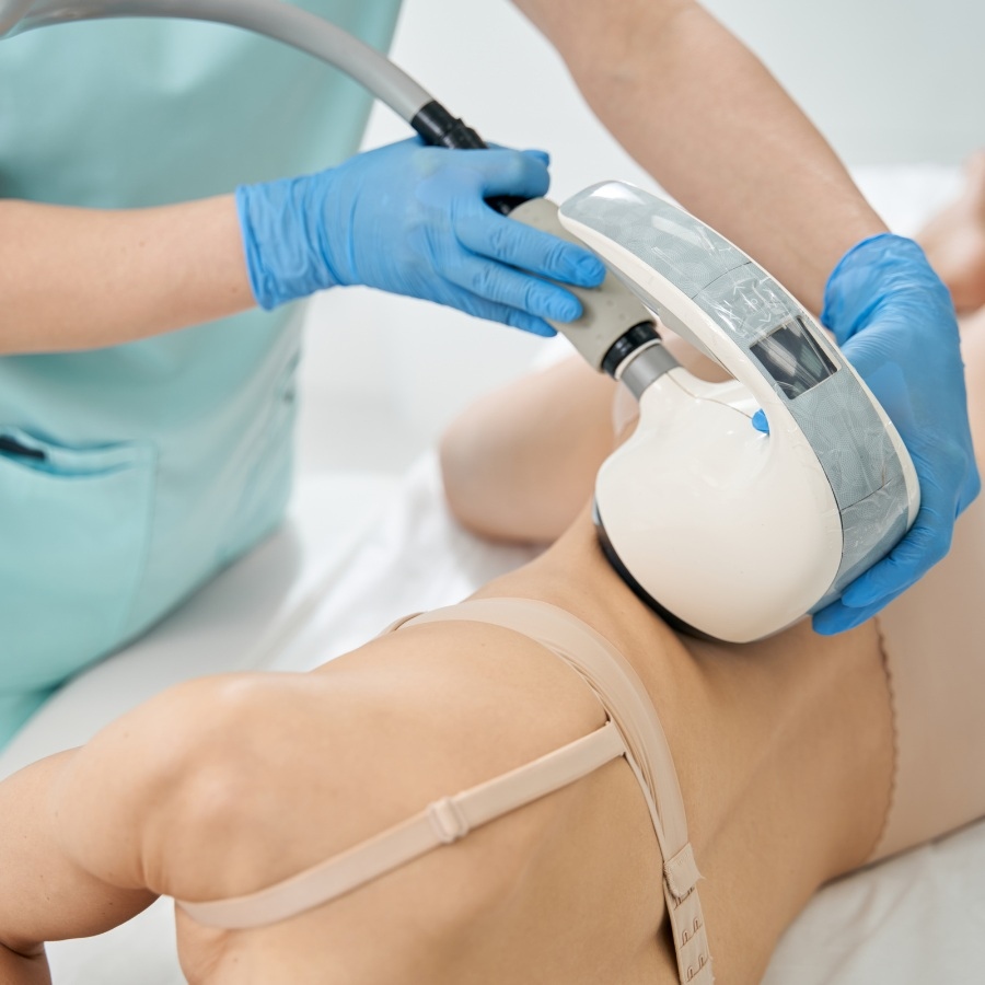 VelaShape Body Contouring Treatment Overview