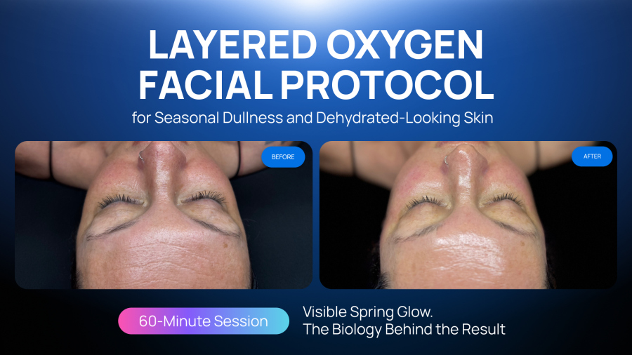 Layered Oxygen Facial Protocol for Seasonal Dullness and Dehydrated-Looking Skin