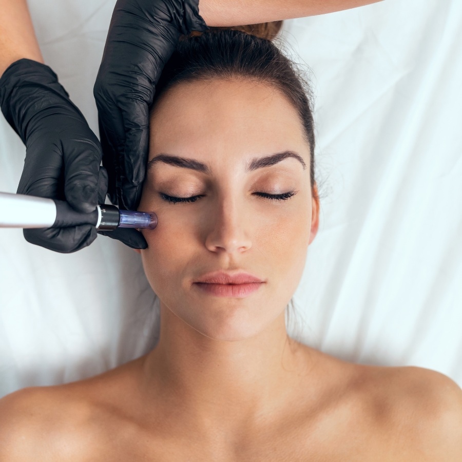 The Pros And Cons Of Dermapen Treatment