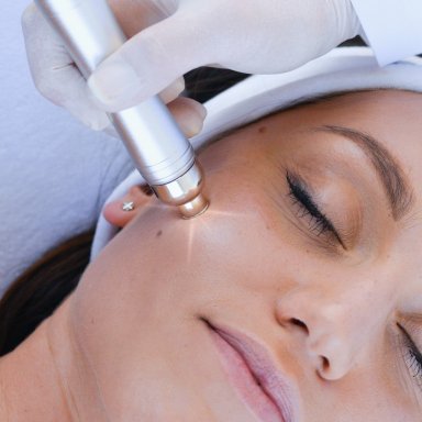 Why Dermabrasion is the Most Popular Facial in the US: Insights on Hydro and Diamond Techniques