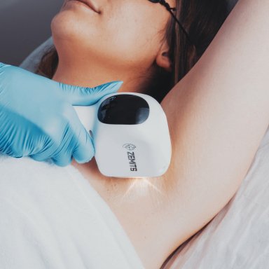 Add Diode Laser Hair Removal to Your MedSpa: Evaluating the Benefits and Drawbacks