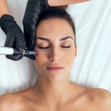 The Pros And Cons Of Dermapen Treatment 