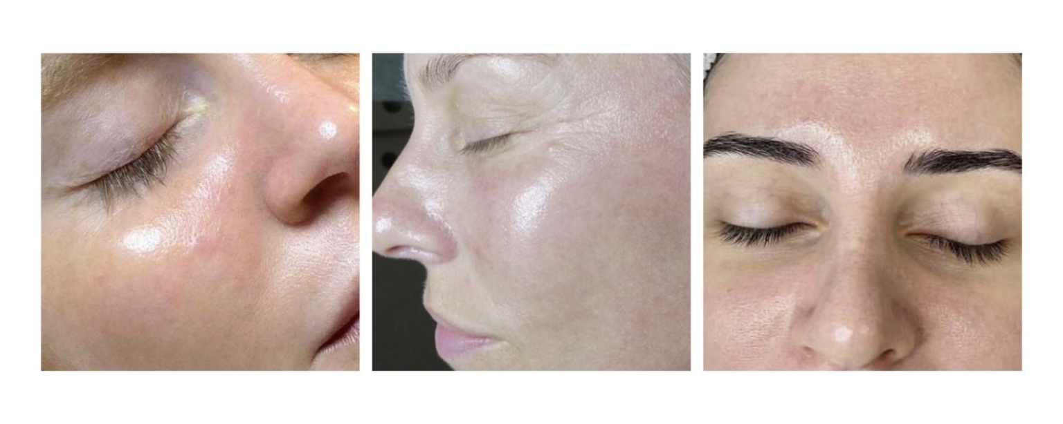 Zemits OxyTight Pro Repairing & Boosting Infusion Serum with