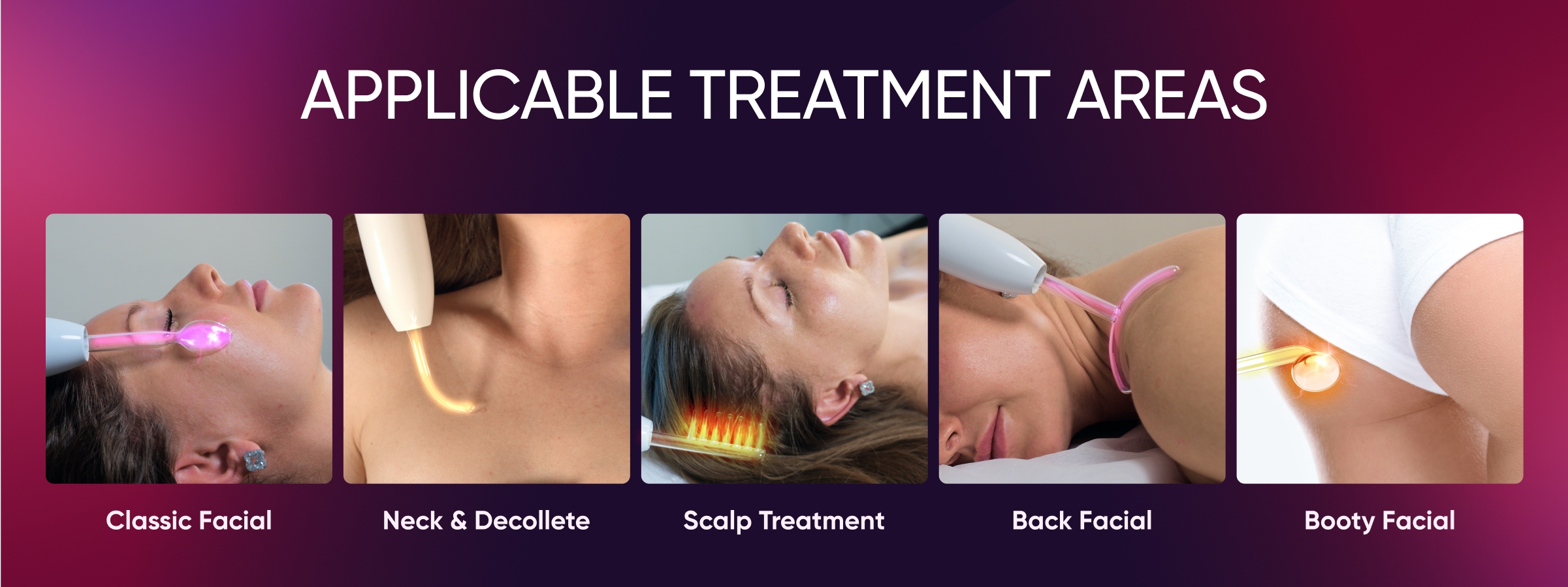 Applicable Treatment Areas.jpg My default image
