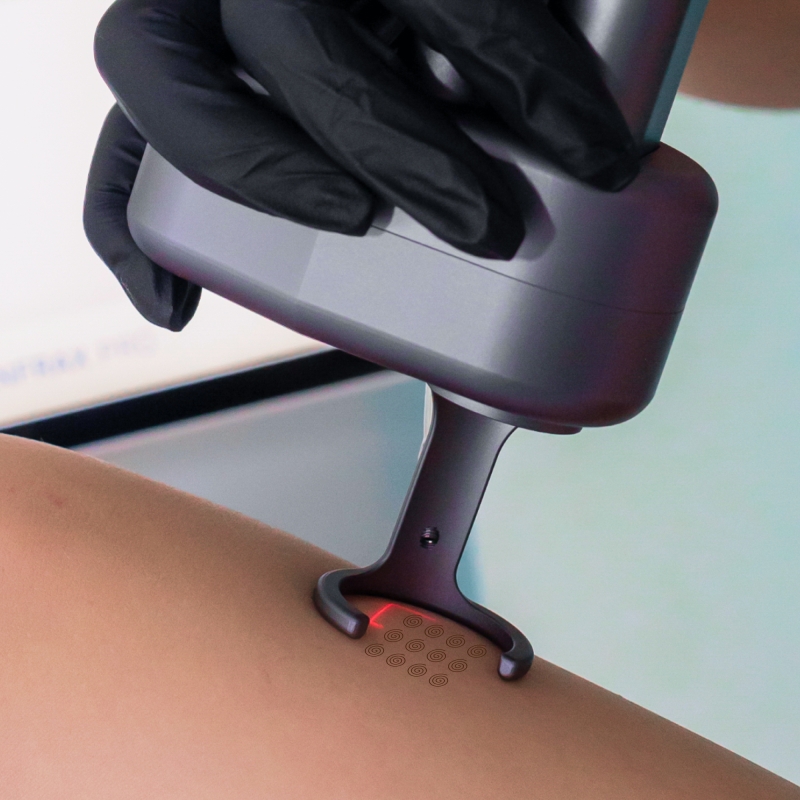 Zemits CarbonFrax Pro CO₂ Laser_resalt_block_4.jpg My default image