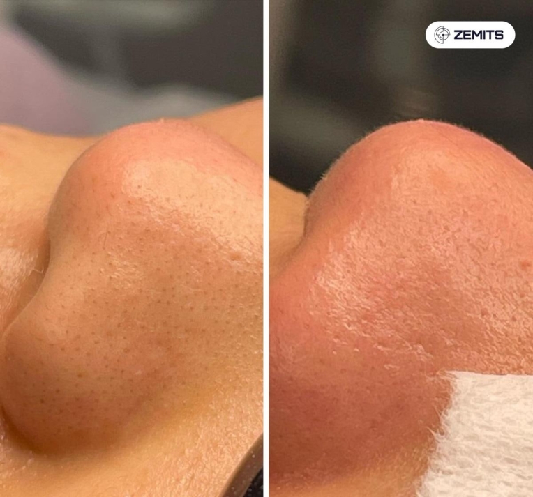 skinexpert107 (1).jpg My default image