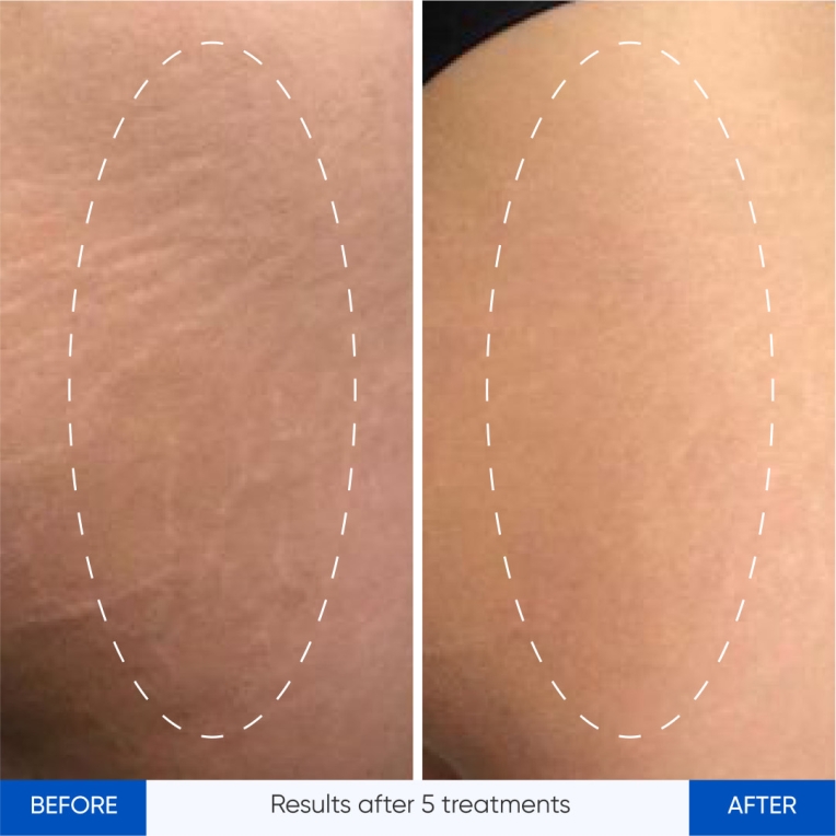 Group 3360015.jpg My default image