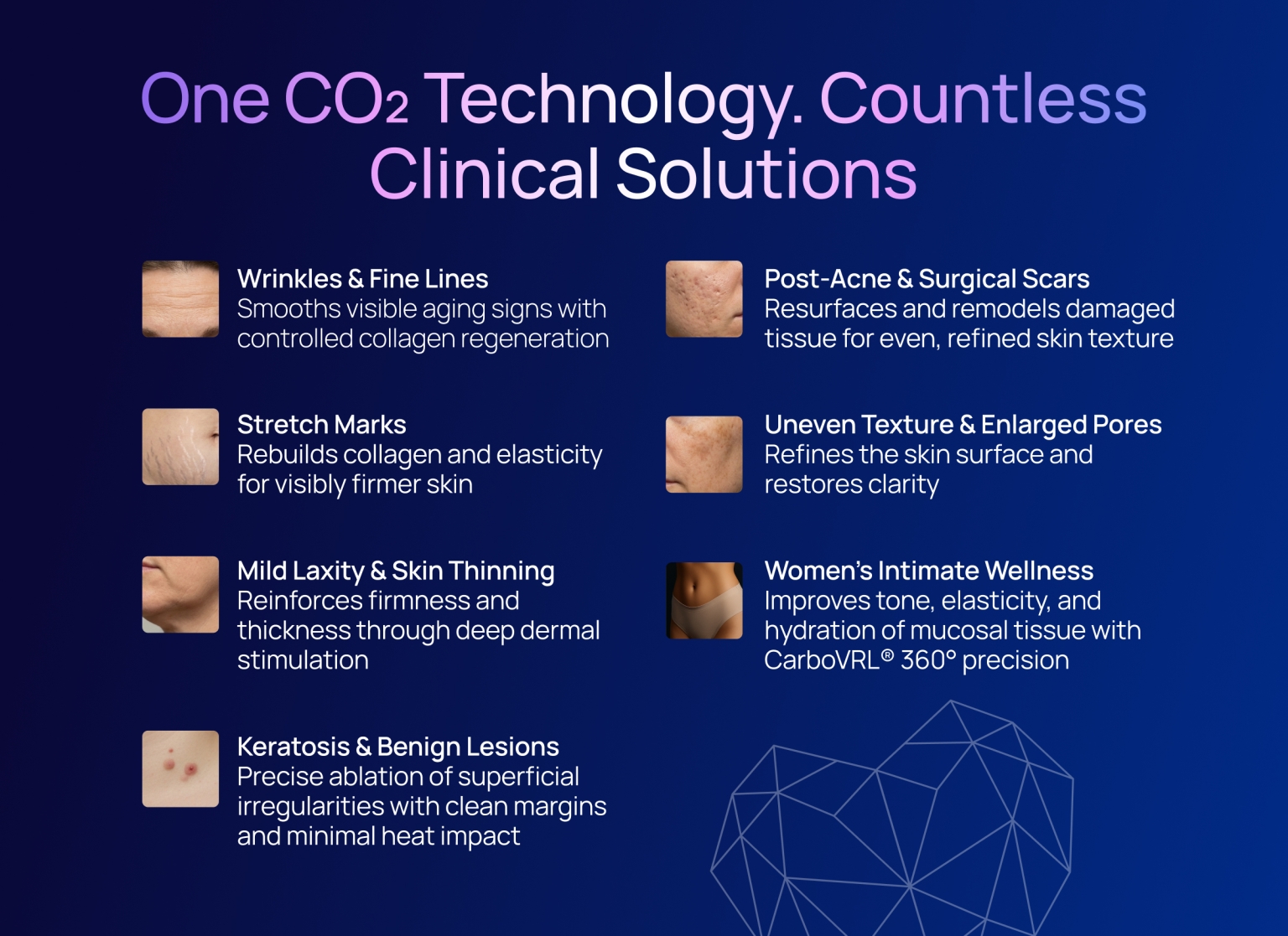 Zemits CarbonFrax Pro CO₂ Laser_resalt_block_6.jpg My default image