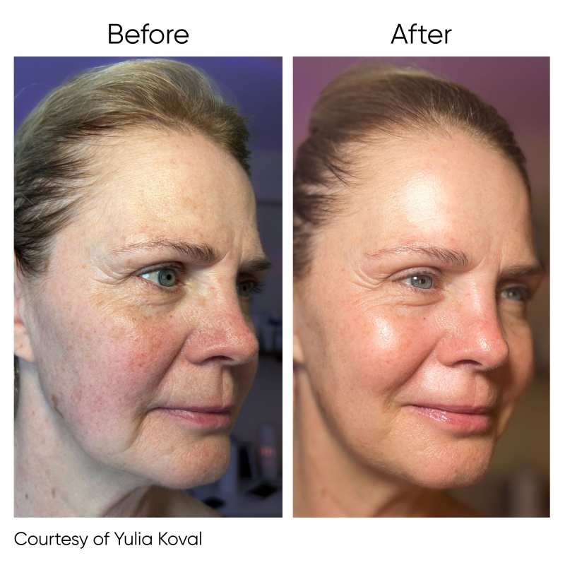 1.jpg My default image