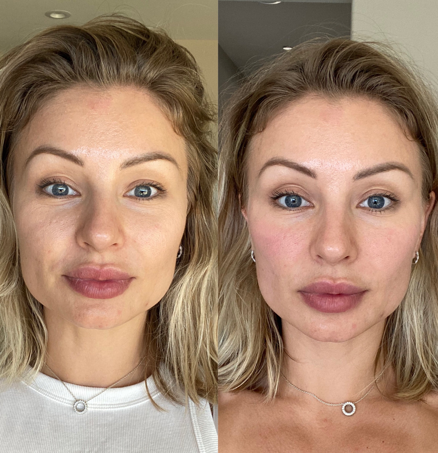 Zemits Adrinox ProGloves Dynamic Microcurrent Gloves Technology FOR SALE