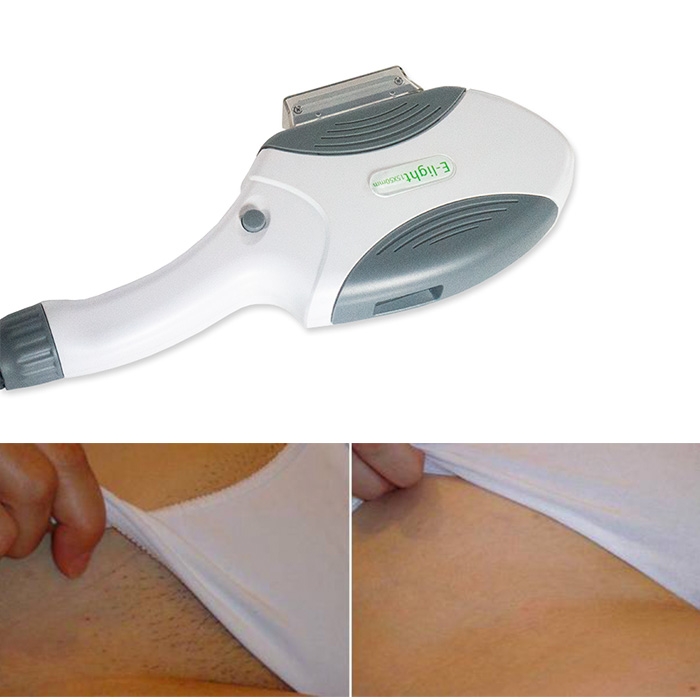 IPL HAIR REDUCTION