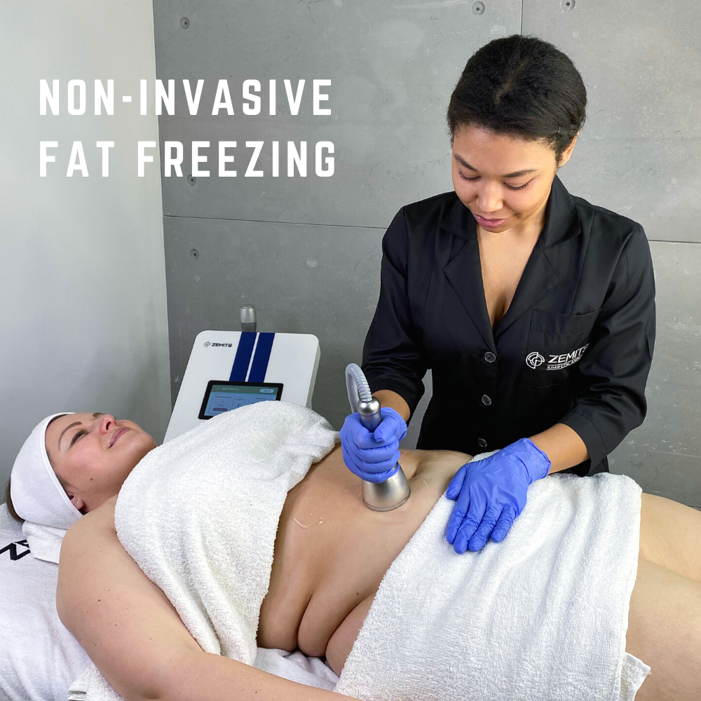 What is Cryo Body Sculpting or Cryotherapy?
