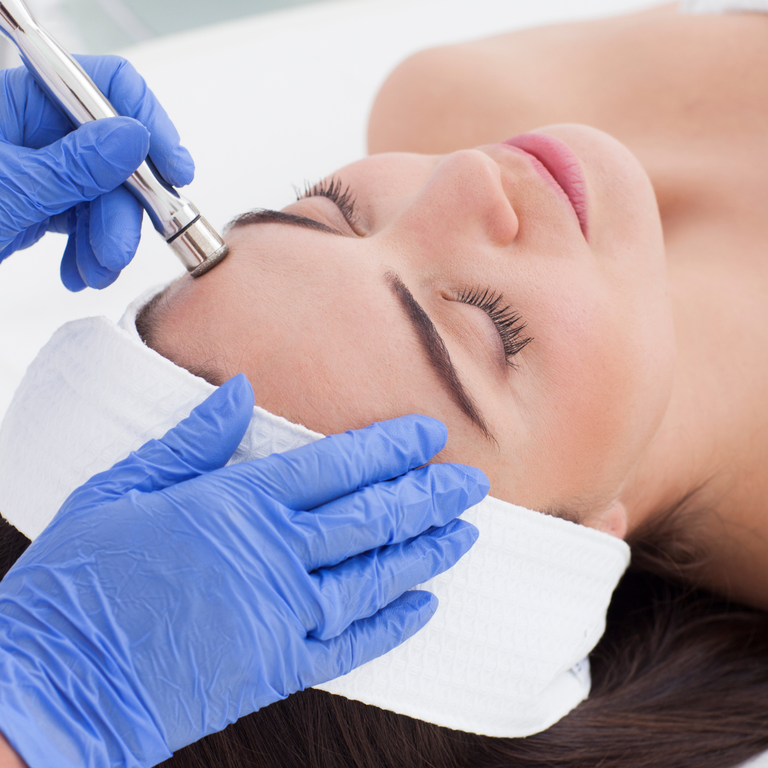 Diamond Microdermabrasion