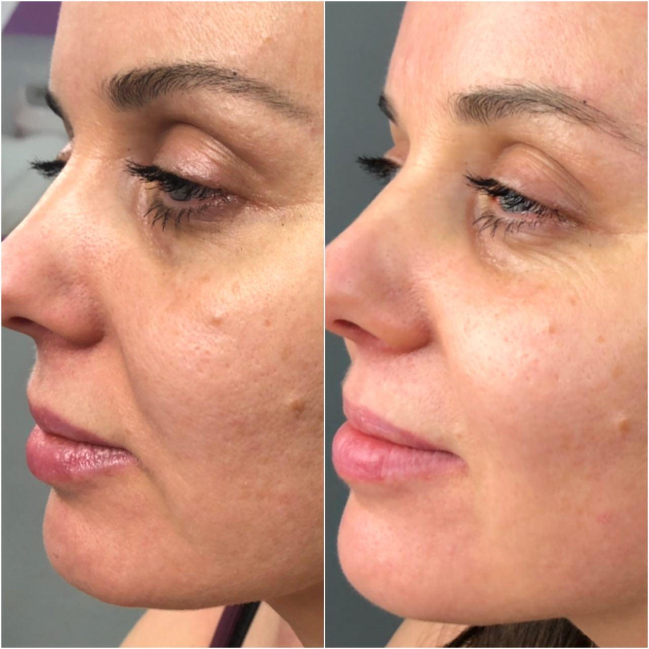 Anti-Aging Treatment Protocol