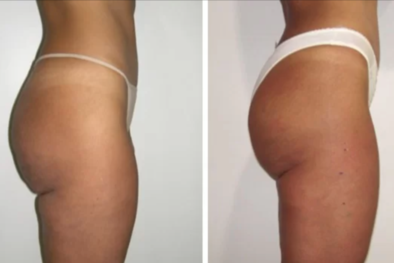 REAL RESULTS FROM BIONEXIS LITE