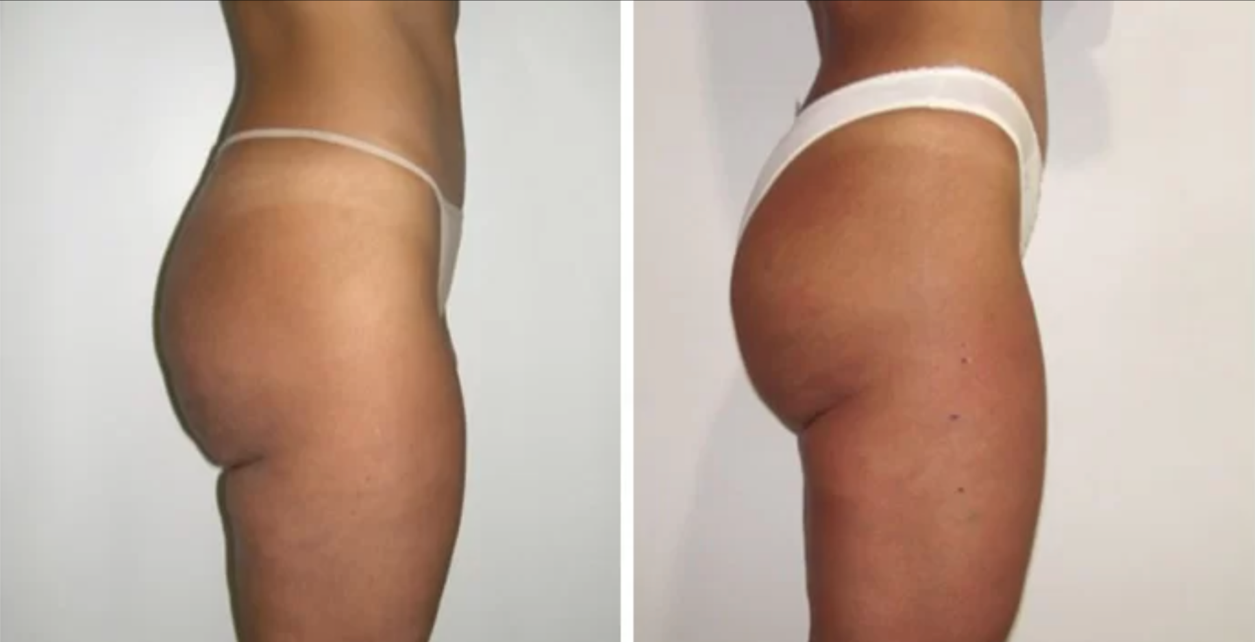 REAL RESULTS FROM BIONEXIS LITE