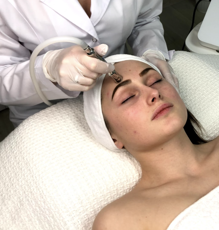 Diamond MicroDermabrasion