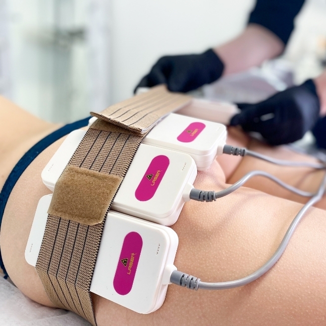 Benefits of VuurLipo Treatment:
