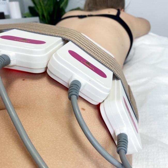 VuurLipo Post-Treatment Recommendations