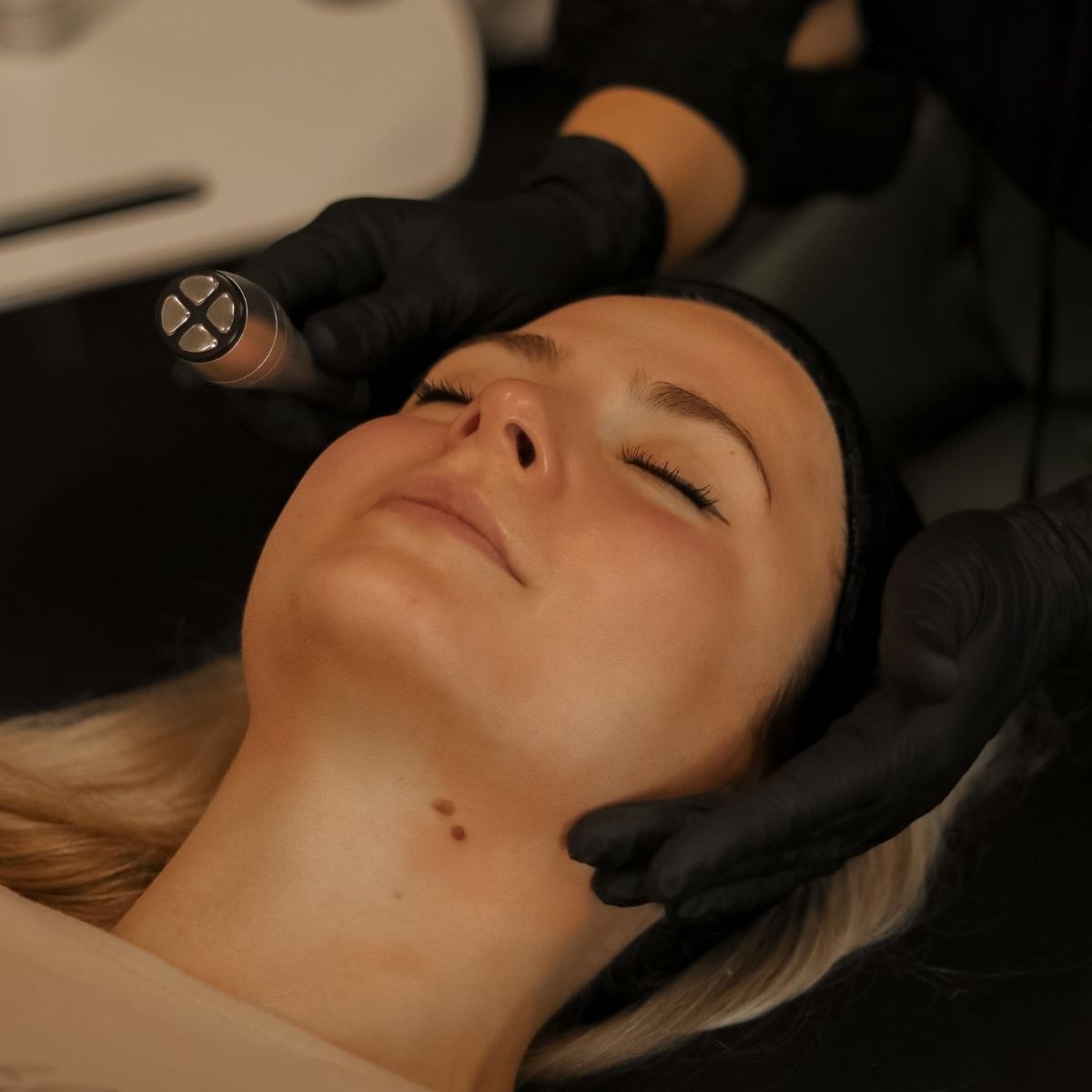RadioFrequency Skin Tightening