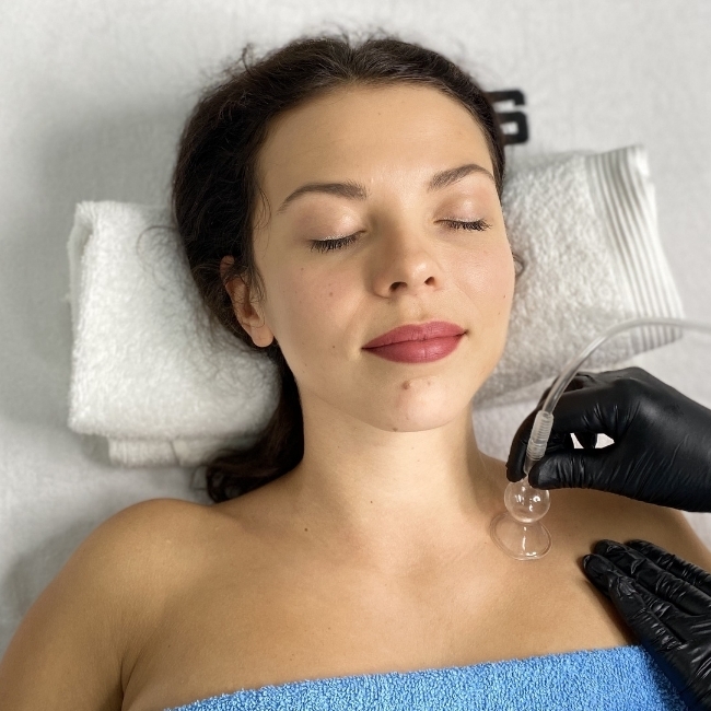 How does facial vacuum cupping work?