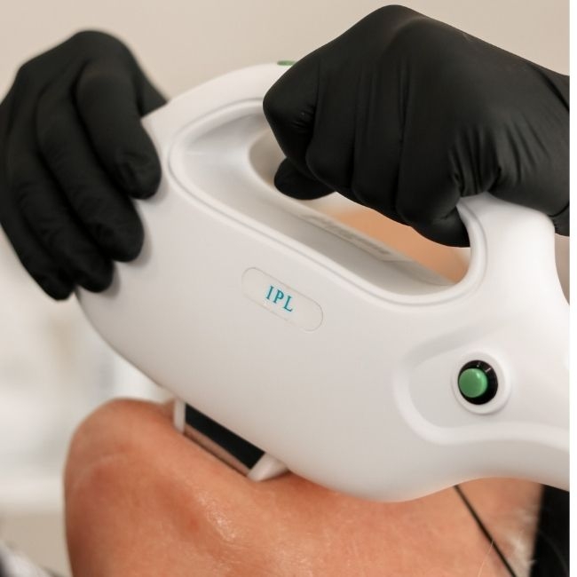 The Zemits DuoCratus IPL handpiece may perform the following procedures: