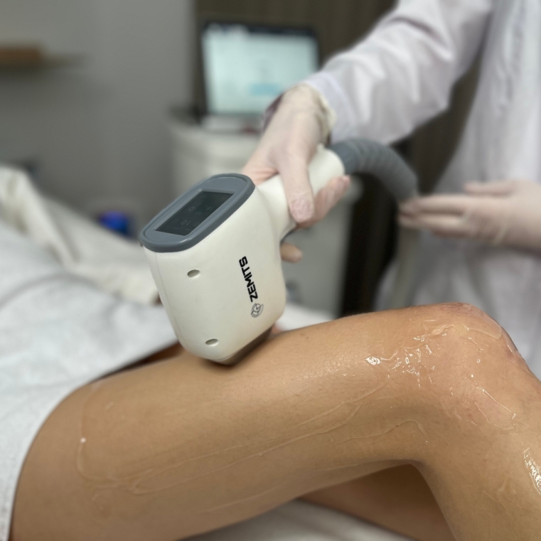Zemits Quidion Diode Laser For Hair Removal  6