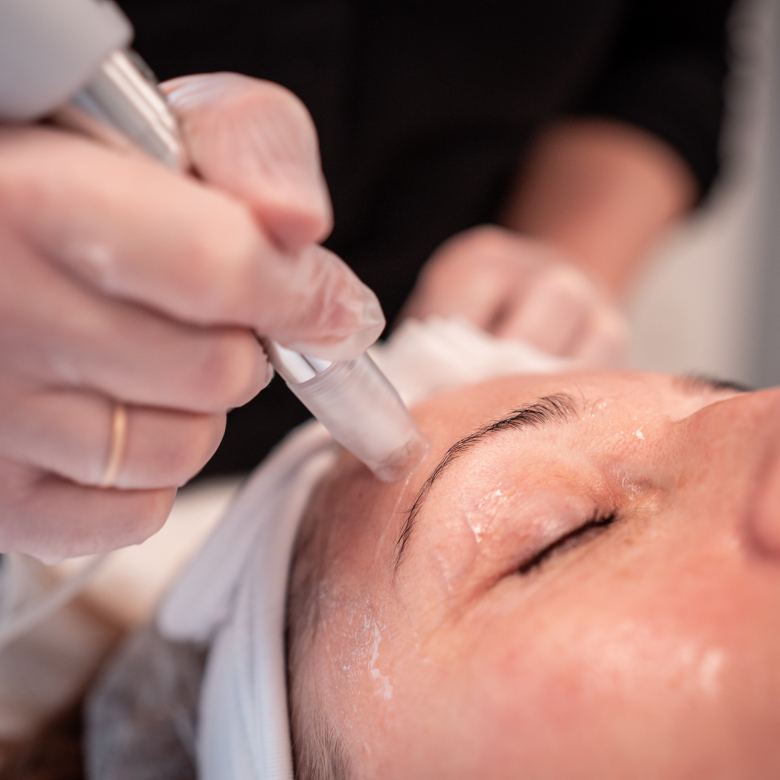 XCellaris PRO Twist 2