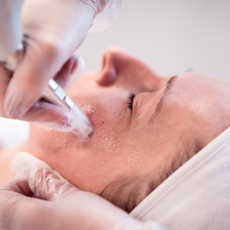 XCellaris PRO Twist 3