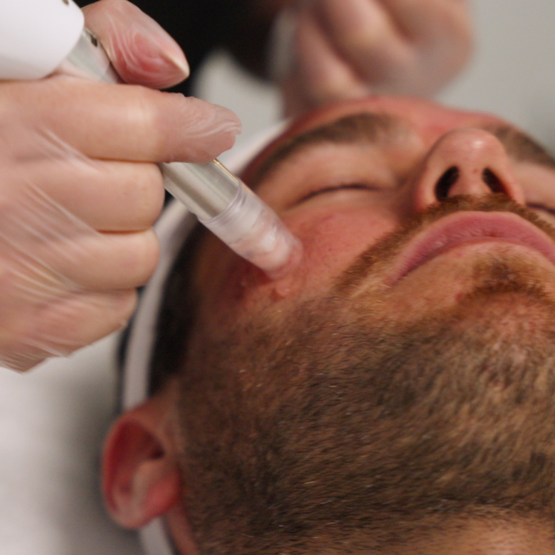 XCellaris PRO Twist