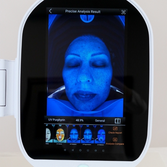 Zemits VeraFace AI Skin Analysis System 3