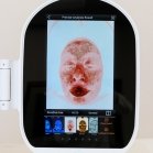 Zemits VeraFace Skin Analyzer System 4 mini