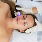 Zemits FrioLift CRYO RF Contrast Skin Rejuvenation System 6 mini